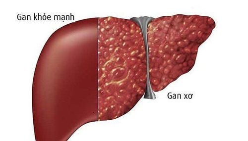 Gan là "nhà máy hóa học" của cơ thể, chịu trách nhiệm giải độc, chuyển hóa dinh dưỡng, điều hòa đường và cholesterol trong máu, đồng thời sản xuất mật để tiêu hóa.