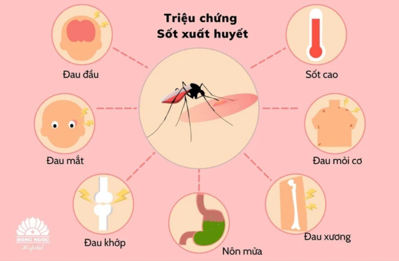 Triệu chứng Sốt xuất huyết
