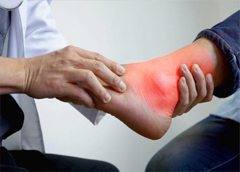 NHỮNG BIỆN PHÁP PHÒNG TRÁNH BỆNH GÚT HIỆU QUẢ
