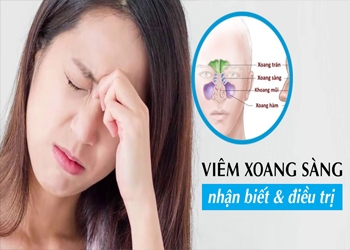 VIÊM XOANG SÀNG VÀ NHỮNG ĐIỀU CẦN BIẾT