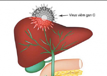 Viêm gan C: Nguyên nhân, triệu chứng, phòng ngừa và điều trị